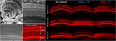 Biosafety and potency of high-molecular-weight hyaluronic acid with intratympanic dexamethasone delivery for acute hearing loss